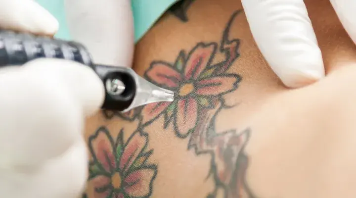 Objawy po tatuażu: Co może oznaczać ból, obrzęk i alergie?